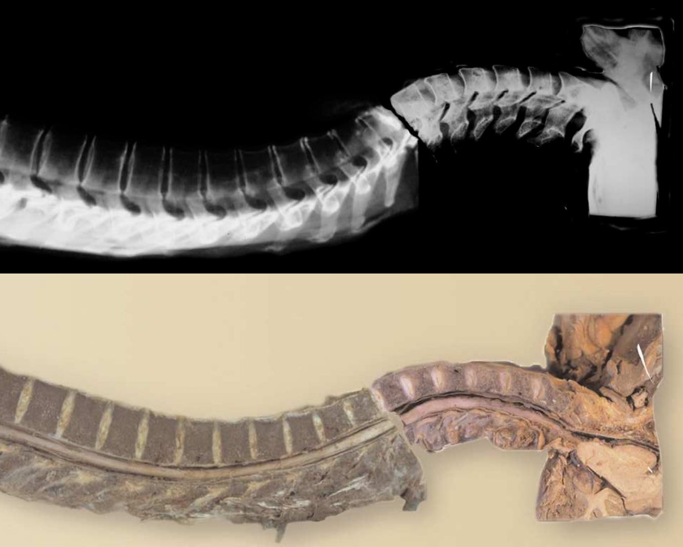 A spine on an X-ray and a preserved spine on a beige background
